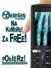 Rentgen w Twoim telefonie! Już teraz zmień za DARMO swoją komórkę w Rentgen! Śruby w kolanie, pęknięte kości, czipy w głowie i wiele więcej... Prześwietlaj swoich znajomych, bedą wprost zszokowani :)